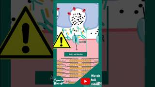 Myasthenia Gravis | Quick Medical Fact | Autoimmune Disease: Myasthenia Gravis Simplified