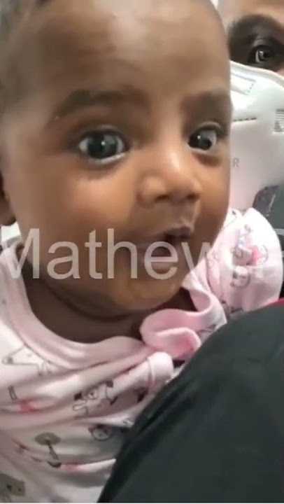 Another Beautiful Smile From A Cleft Lip Baby - Cleft Lip Repair In India | Dr Mathew PC #shorts