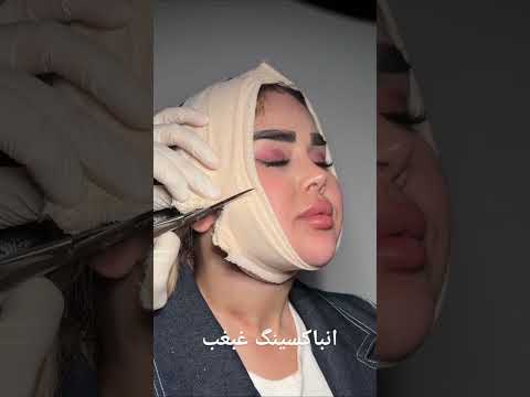آنباکس غبغب ایرانوی لاین زاویه سازی دائمی کلمه غبغب و دایرکت کن ت تخفبگیر کلینیکمهرزاد کلینیکزیبا