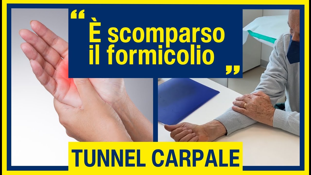 Video testimonianza