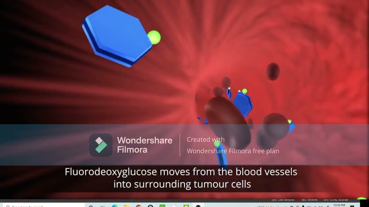 |Introduction to Nuclear Medicine||Various Scintigraphy studies|| Positron Emission Tomography