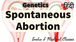 Spontaneous Abortion !! Types !! Causes !! Management !! Hindi !! Genetics !!