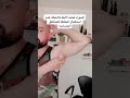 اسمرار او اغمقاق لون الابط و طريقة حلها 