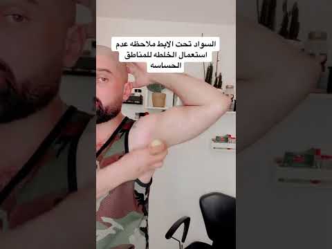 اسمرار او اغمقاق لون الابط و طريقة حلها