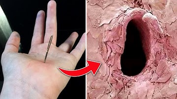 10 Things You Can Only See Under Microscope