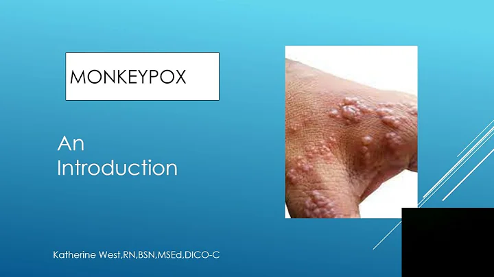 Here's What You Need to Know about Monkeypox