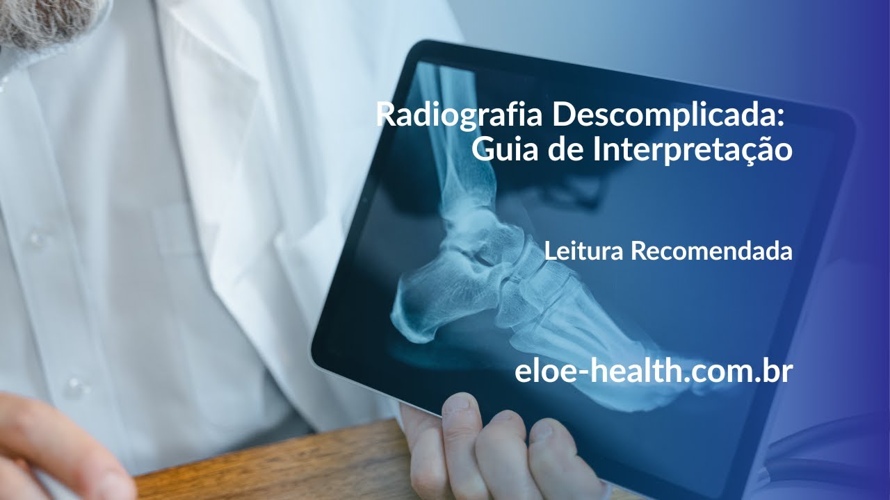 Médico segurando tablet com imagem radiológica de um pé.