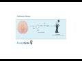 Decoding Parkinson's Disease Insights into a Complex Neurological Disorder
