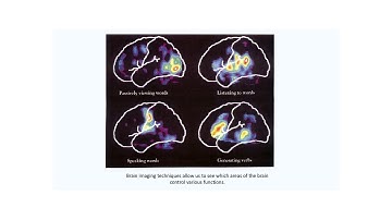 Cognitive Skills and Second or Other Language Acquisition