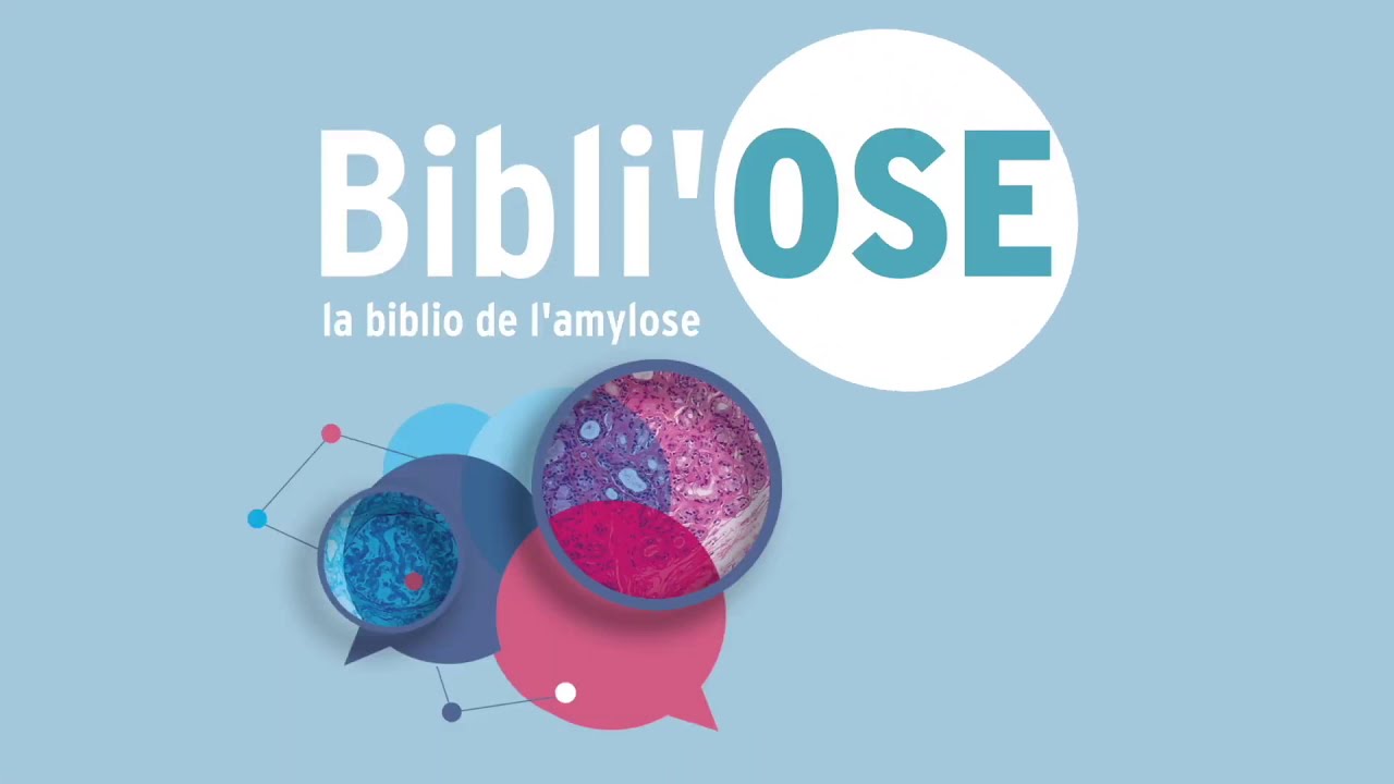 Cardiac Implantable Electronic Devices in Cardiac Amyloidosis. Article PMID: 32972550