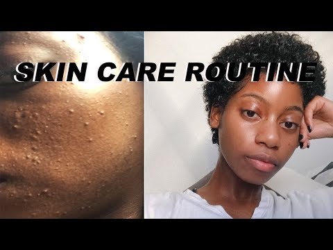 HOW I CLEARED MY ACNE PRONE SKIN FAST !