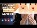 MATSALAR INFECTION Mai Haddasa Warin Jiki Da Maganinsa
