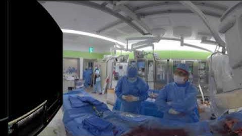 EVAR with IBD, Iliac Branch Device