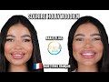 Réalise un sourire hollywoodien avec le secret des dents parfaites d'iMed Dent