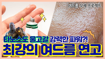 무엇과도 비교할 수 없는 강력한 효과의 여드름연고 찾기