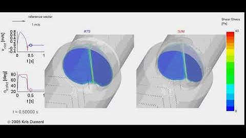 FSI simulation of heart valves