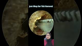 Just Okay Ear Tick Removal