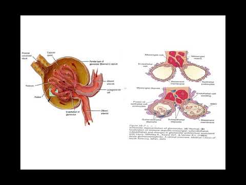 Video: Glomerulonefritis - Pengobatan Glomerulonefritis Dengan Pengobatan Dan Metode Tradisional