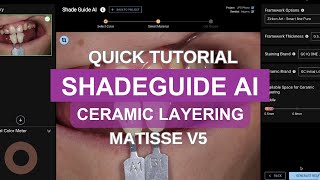 Matisse v5- ShadeGuide AI [Ceramic Layering]
