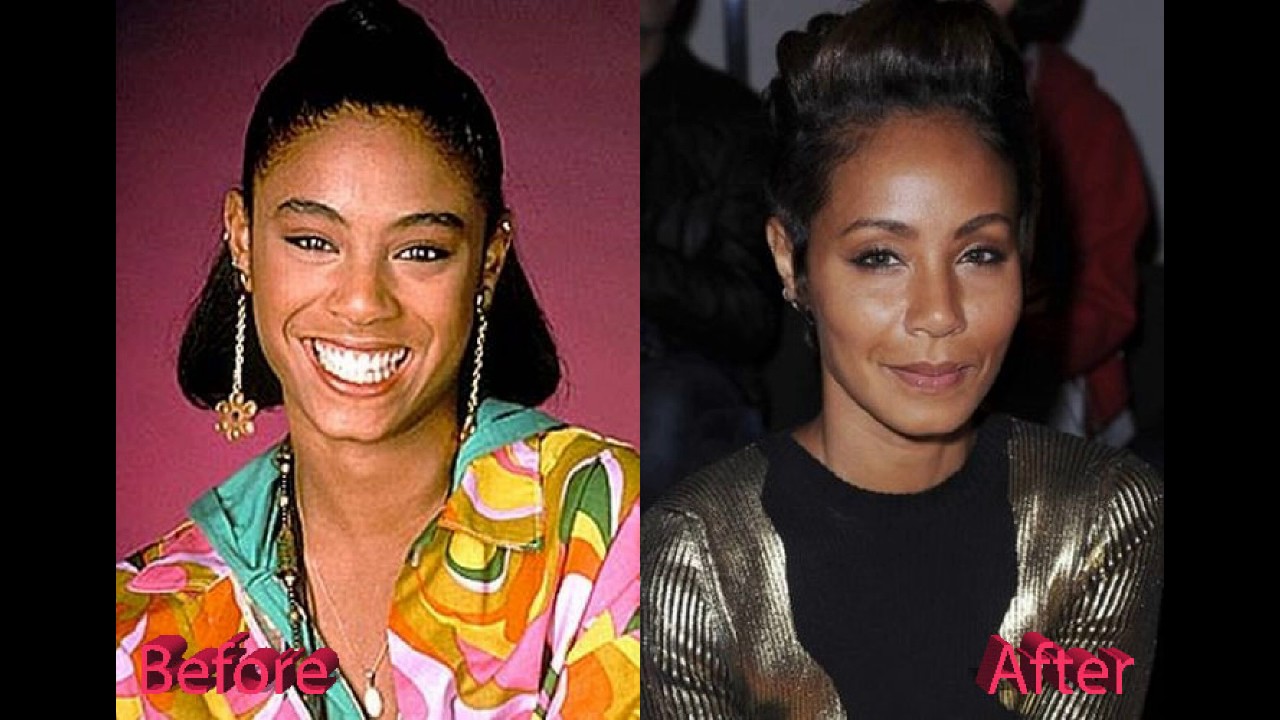 Jada Pinkett Smith plastic surgery before and after photos ...