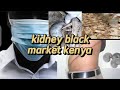 Shocking selling kidney for motorcycle kenya sebstvkenya blackmarket must watch