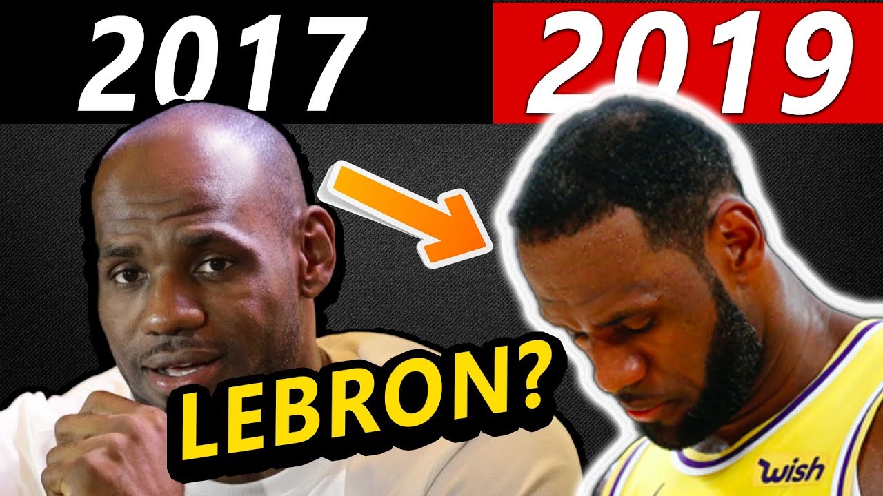 Celebrity Hair Transplant Transformations Part 4!