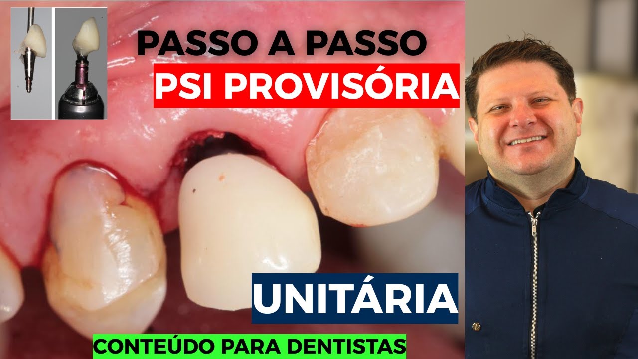 Pronta Psi PASSO A PASSO: PSI PROVISÓRIA UNITÁRIA - carga imediata - YouTube