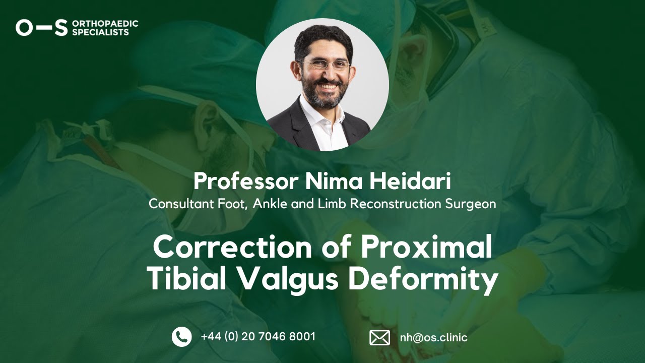 Correction of Proximal Tibial Valgus Deformity | Prof Nima Heidari | Orthopaedic Specialists