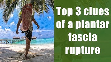 Top 3 clues of a plantar fascia rupture in a runner