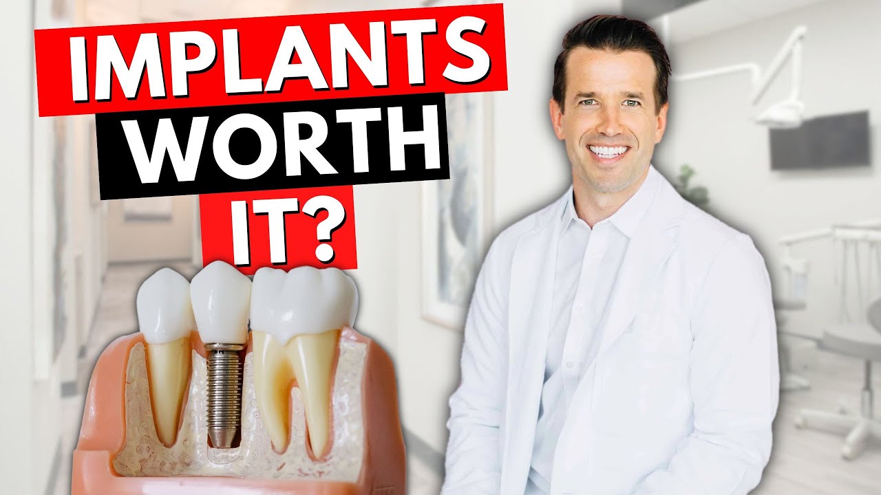 Dental Implants - Options for Missing Teeth