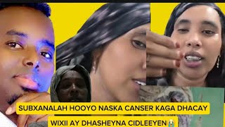 SUBXANALAH HOYO NASKA KAGA DHACAY KANSAR CIYALKA AY DHASHEYNA KA TAGEN