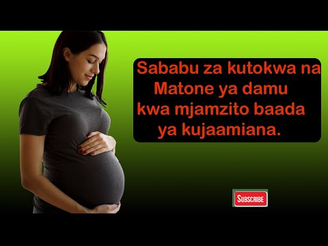 Video: Jinsi Ya Kueneza Clematis? Uzazi Kwa Kuweka Katika Chemchemi Na Majira Ya Joto Nyumbani. Jinsi Ya Mizizi Ndani Ya Maji Na Kupanda?