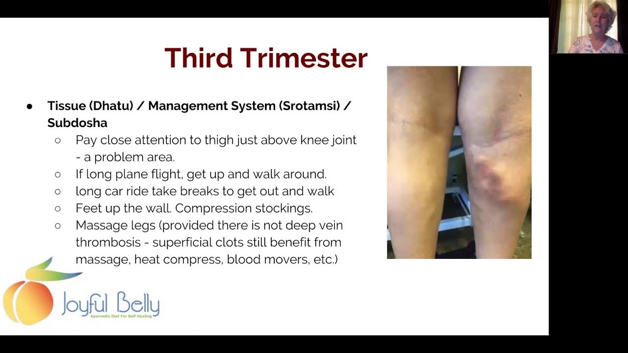 3rd Trimester Stretch Marks Varicose Veins Constipation Ayurvedic Care For Pregnancy 4 Of 6 Youtube