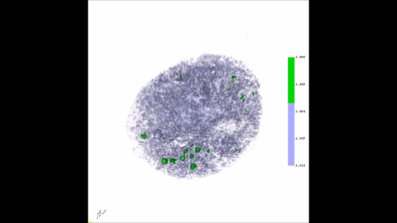 Molecular Camouflage of Plasmodium falciparum Merozoites by Binding of Host Vitronectin to P47