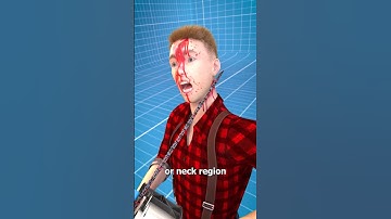 Thumbnail of How Chainsaw Kickback Works 😬