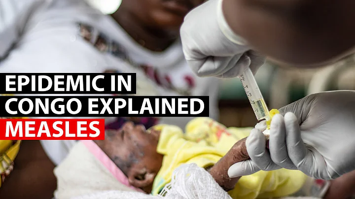 Explained: The world’s largest measles outbreak