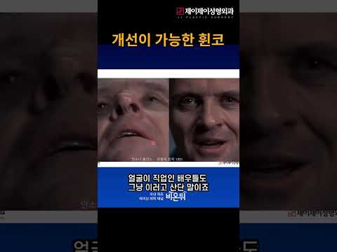 개선이 가능한 휜코 #<strong>코수술</strong> #shorts