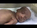 Newborn baby under observation || cute baby in inkebuter care #nicubabycare #cutebaby #observation 