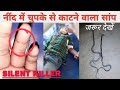 || SNAKE BITE नींद में चुपके से काटने वाला सांप । silent killer snake ||