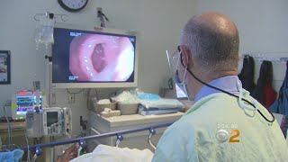 Colon And Rectal Cancers On The Rise In Young People