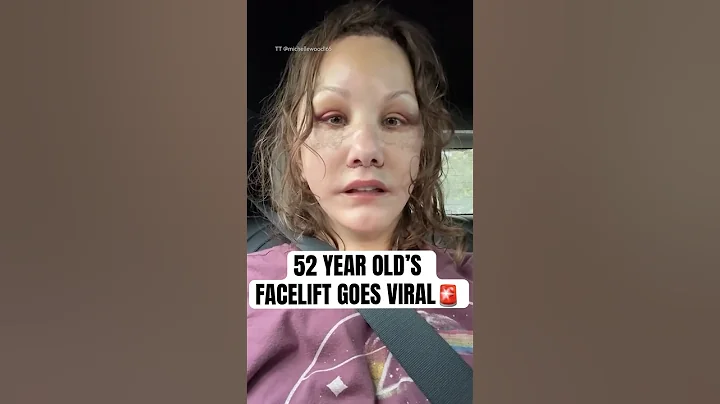 "I Don't Recognise Myself Anymore" #shorts #facelift #plasticsurgery