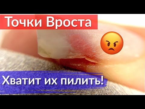 Как не пропилить ТОЧКИ ВРОСТА ногтя | Ошибки в маникюре