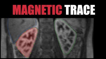 FireVoxel Tutorial 8: Introduction to Magnetic Trace Tool