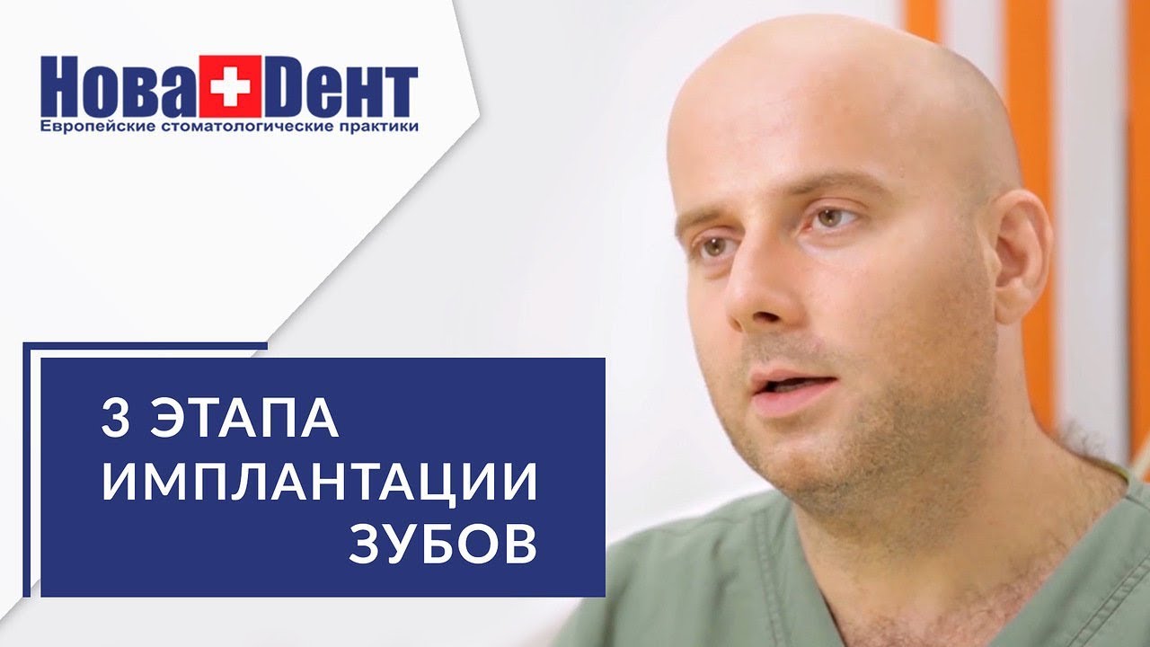 Имплантация зубов этапы. 📋 Подробная консультация стоматолога о каждом ...