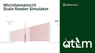 Microhematocrit Scale Reader Simulator