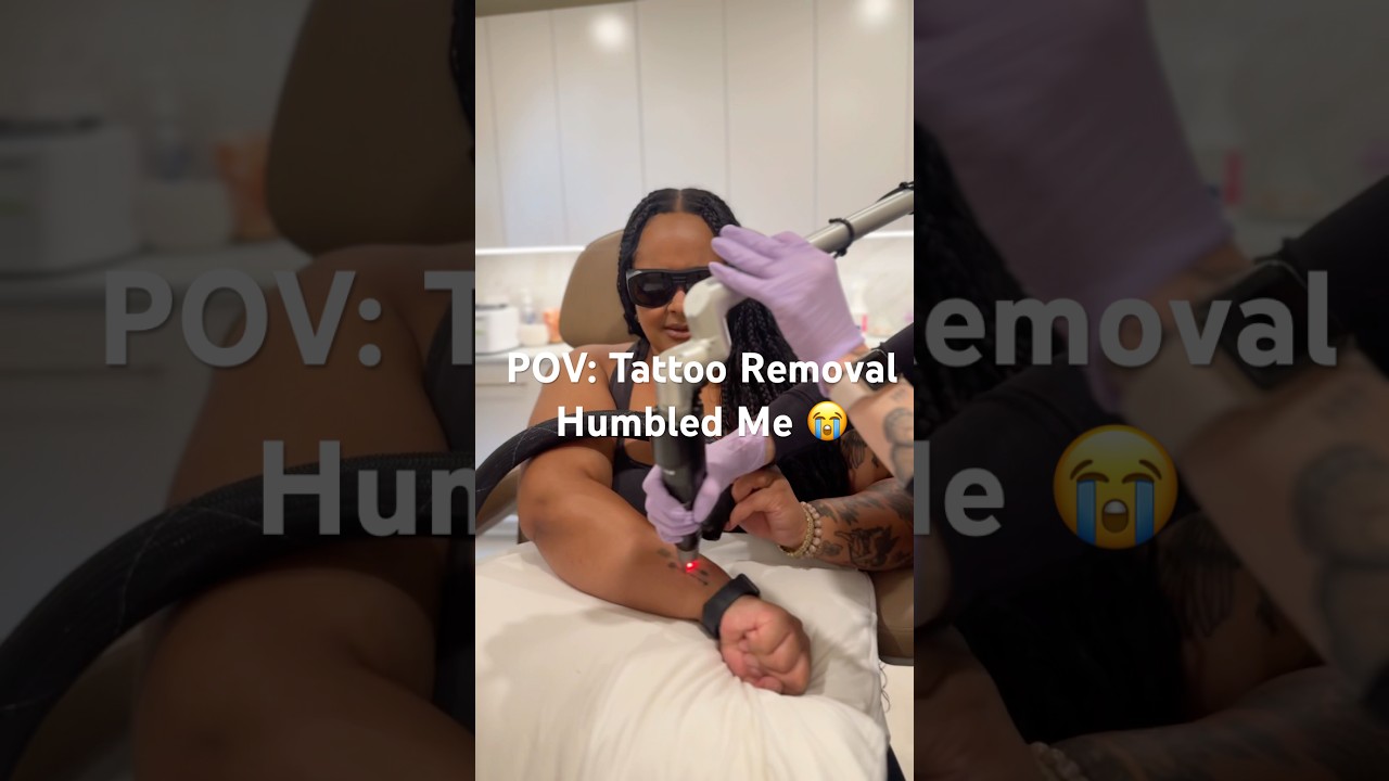 I Got Fired Mid Tattoo Removal 💀