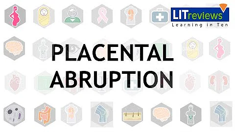 Placental Abruption - DayDayNews