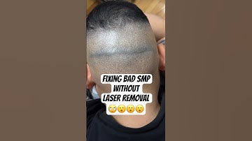 Fixing Bad SMP without Laser Removal