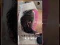 Hair Restoration Treatment | Hair Fall Control & Natural Regrowth at Asthederm