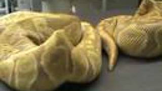 Celebrity Kinked Caramel Albinos Wealth